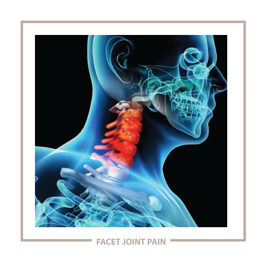 Facet joints can cause neck pain
