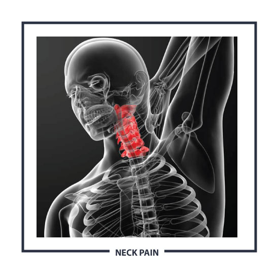 Can Chiropractic help with neck pain?