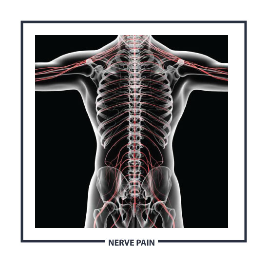 Can Chiropractic help with nerve pain?