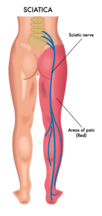 Regions supplied by the sciatic nerve
