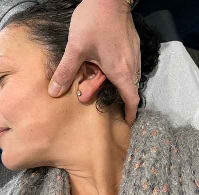 Chiropractor treating a TMJ